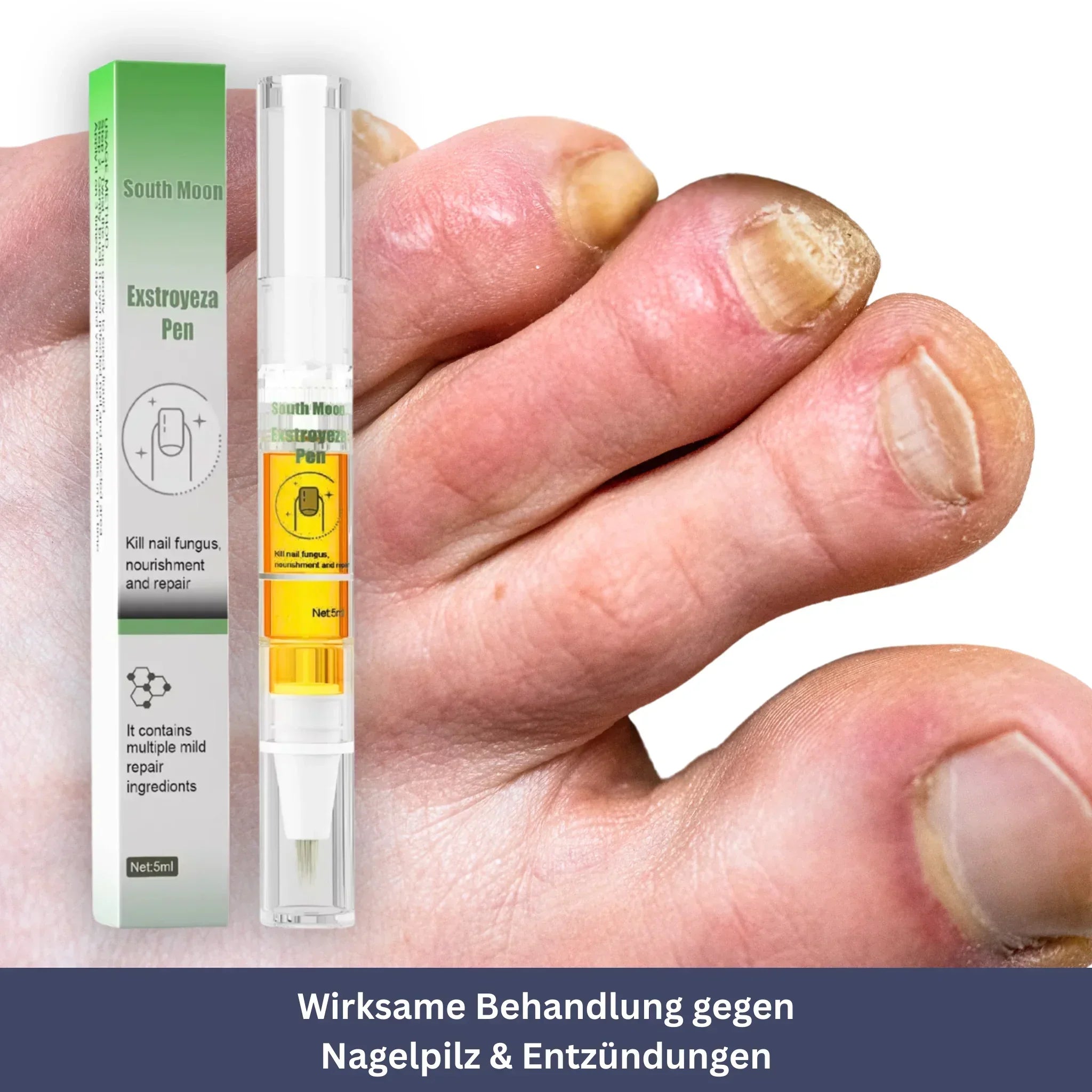 NailPen – Repair Pen for Nail Fungus & Inflammation