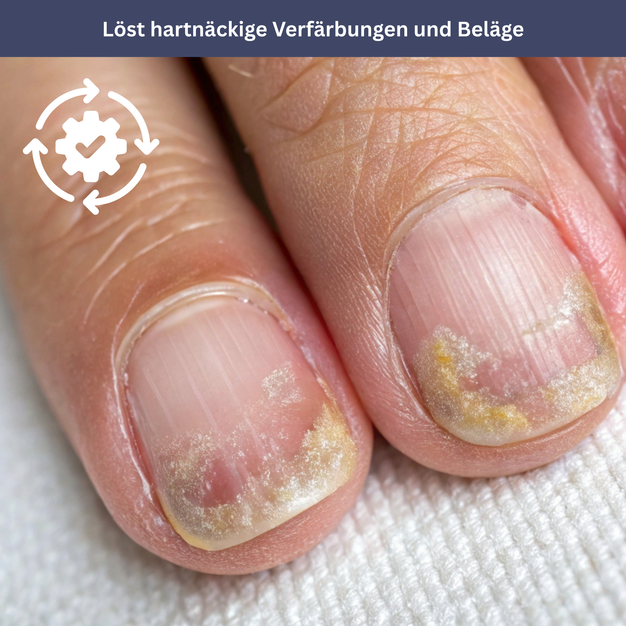 NailDrops – Care Serum for Nail Fungus