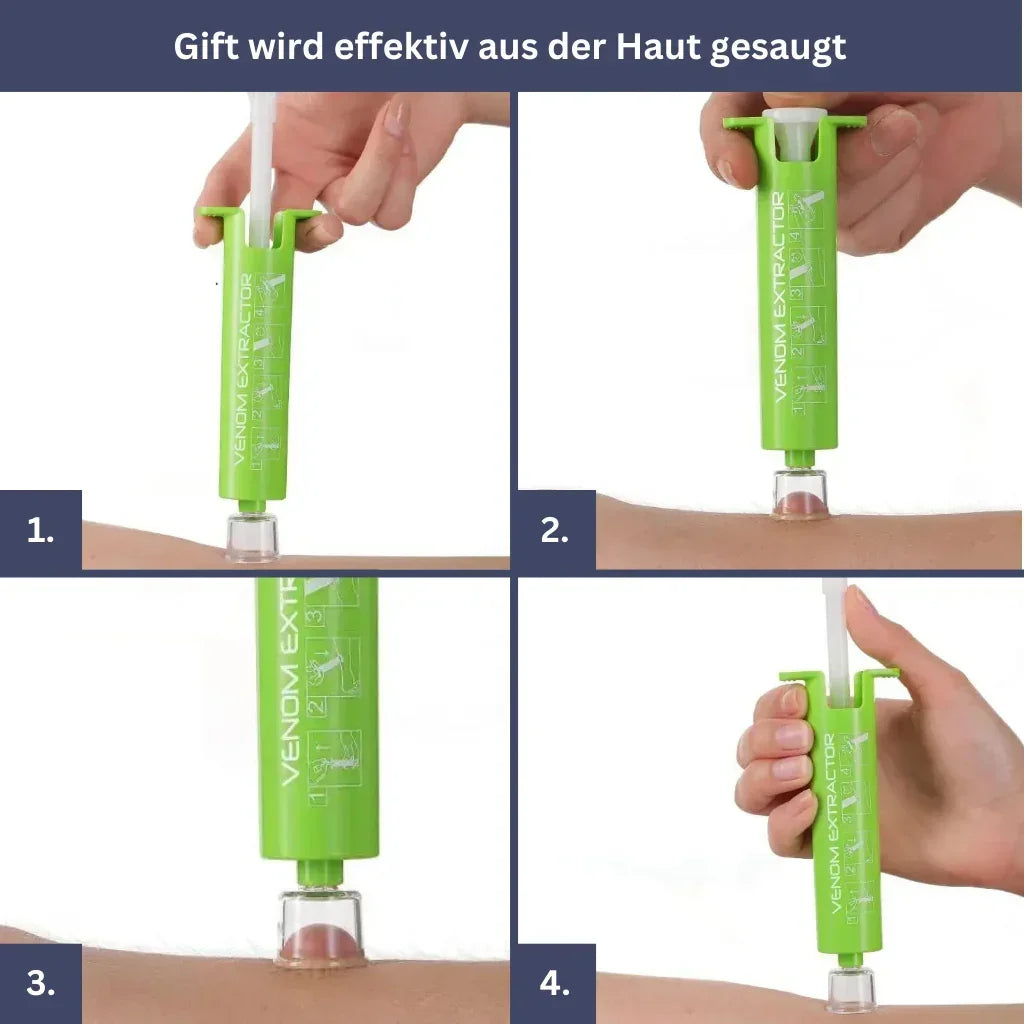 Anti-Insect Bundle – Sting Healer, Venom Extractor, Mosquito Bracelet