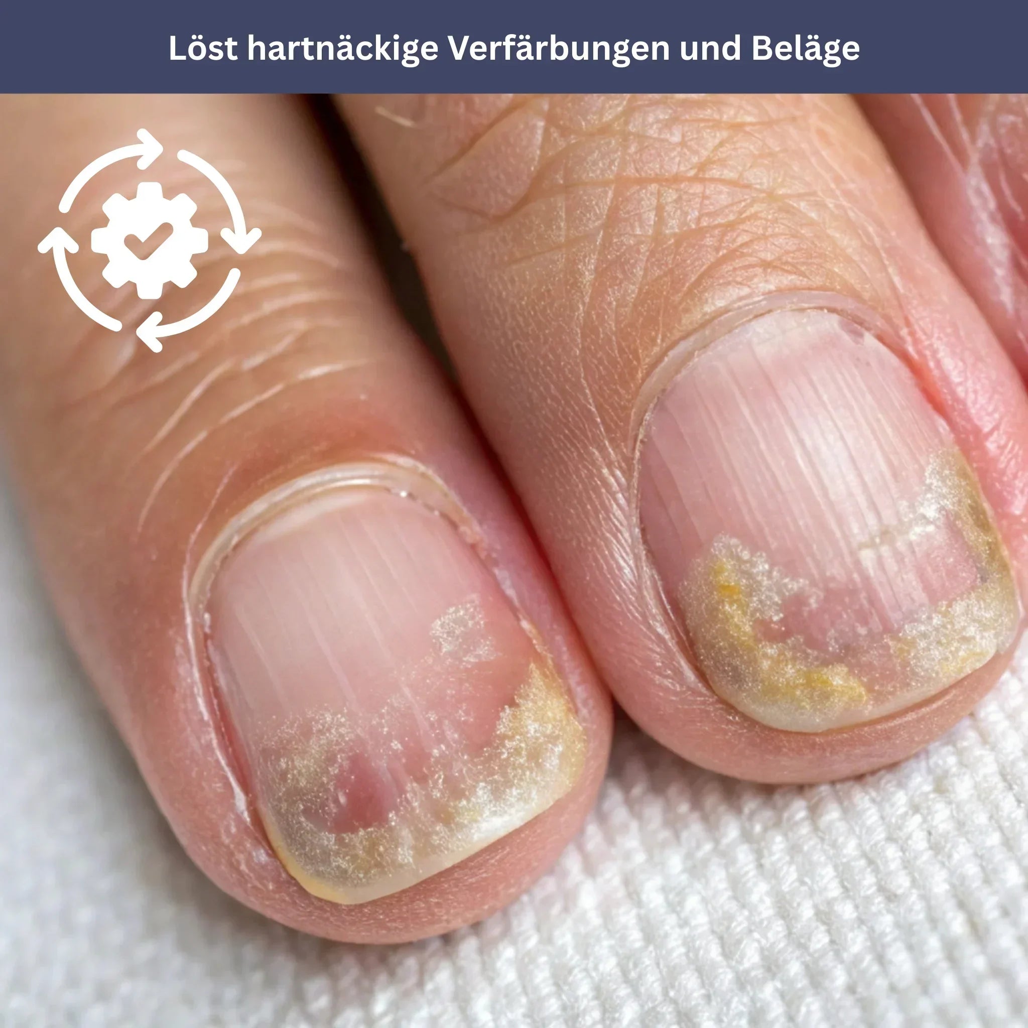 NailDrops – Care Serum for Nail Fungus